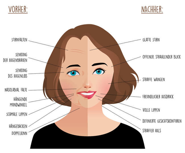 Gesichtsyoga als Anti Aging Programm